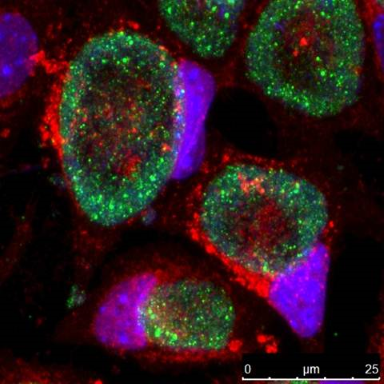 Green fluorescent Chlamydia trachomatis