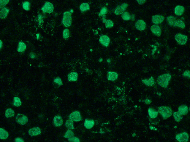 FITC stained, chlamydia-infected McCoy cells