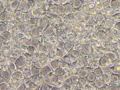 McCoy cells infected with strain L2b