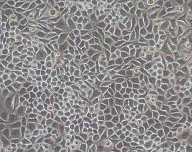 Sub-confluent McCoy cells